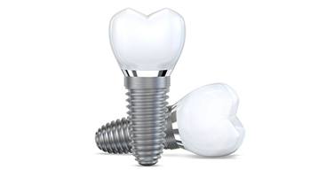 Two dental implants and crowns against white background