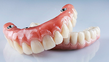 dentist holding a model of an implant denture 