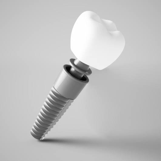 Animated parts of a dental implant supported replacement tooth