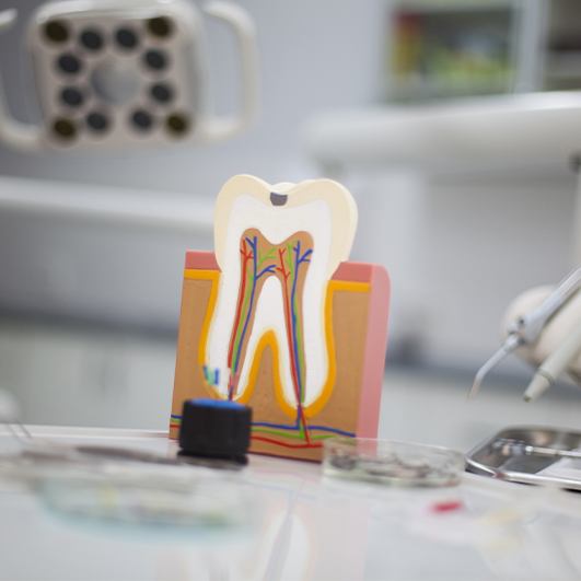 Model of the inside of a healthy tooth that doesn't need root canal therapy