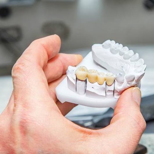 Dental bridge in Barnegat on clay model