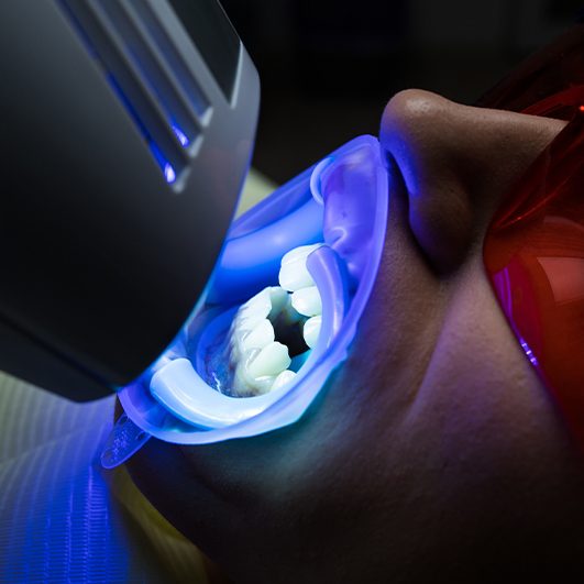 Patient receiving professional teeth whitening