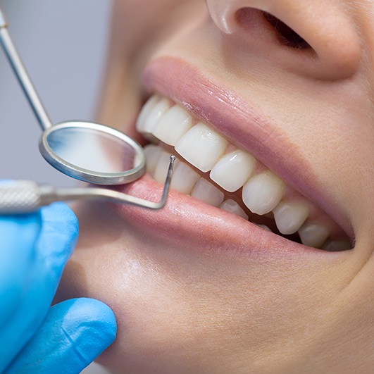 Closeup of smile during gum recontouring treatment