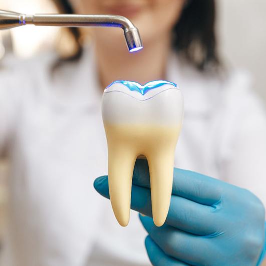 Dentist demonstrating tooth-colored filling on large model tooth 