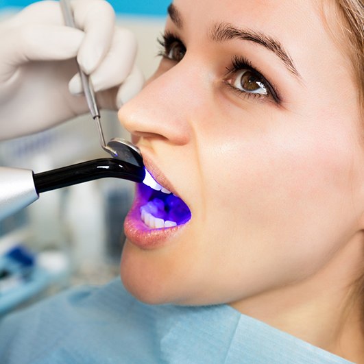 Closeup of dentist hardening woman’s filling with UV light