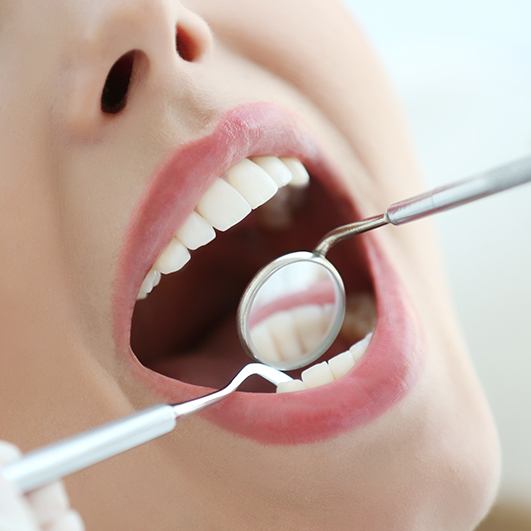 Patient receiving scaling and root planing periodontal therapy