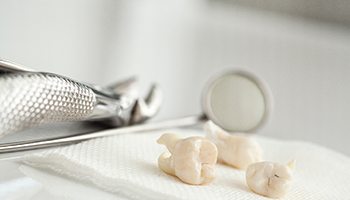 Close-up of three extracted teeth next to dental instruments 