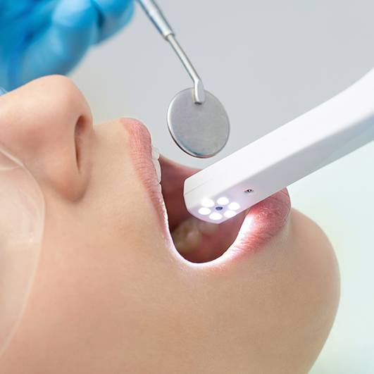 Dentist using intraoral camera to capture images