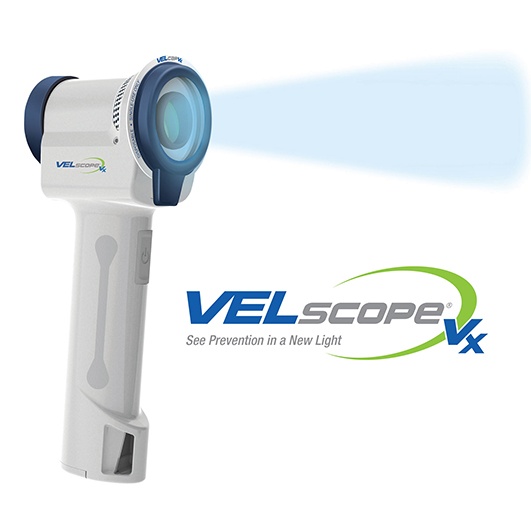 VELscop oral cancer screening device