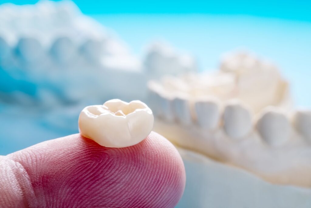 Dental crown on a fingertip with model jaw in background